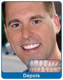 Depois do aparelho dentário - paciente 3