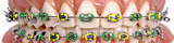 Simulador de cores do aparelho dentário